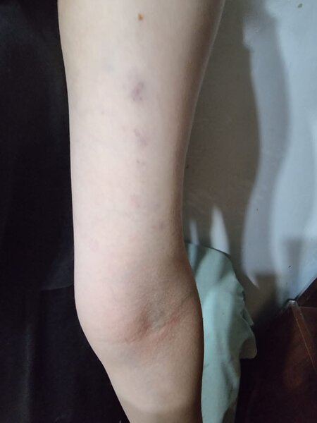 İcra başçısının müavini tərəfindən döyüldüyü iddia olunan qız xəstəxanaya yerləşdirildi – YENİLƏNİB + FOTO