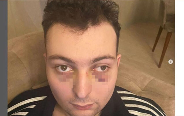 Ticarət mərkəzində döyülən oğlanla bağlı araşdırma başladı - Foto