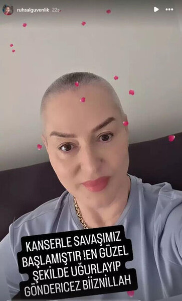 "Kurtlar Vadisi"nin aktrisasından üzücü XƏBƏR – FOTO