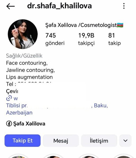 Şəfa Xəlilova dolğu,inyeksiya, botox prosedurlarını necə icra edir? -Fotofaktlar