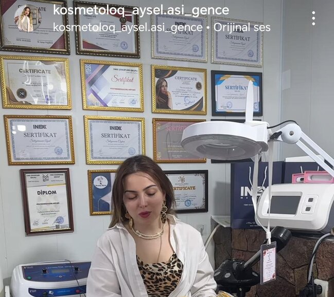 Gəncədə "ixtisaslaşmış kosmetoloq" Aysel Süleymanova tibbi sertifikatı və lisensiyası olmadan necə fəaliyyət göstərir?