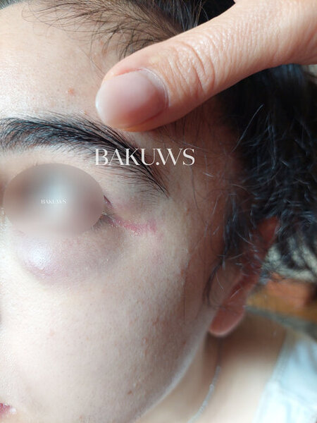 Bakı məktəbində sinif yoldaşları məktəbli qızı vəhşicəsinə döydülər - FOTO/VİDEO