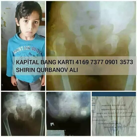 Aytənin köməyinizə ehtiyacı var