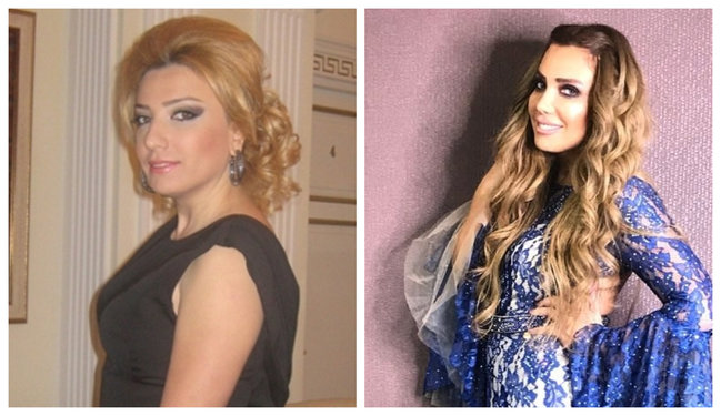 Burun əməliyyatı etdirən aparıcımızı görənlər şokda - FOTOLAR