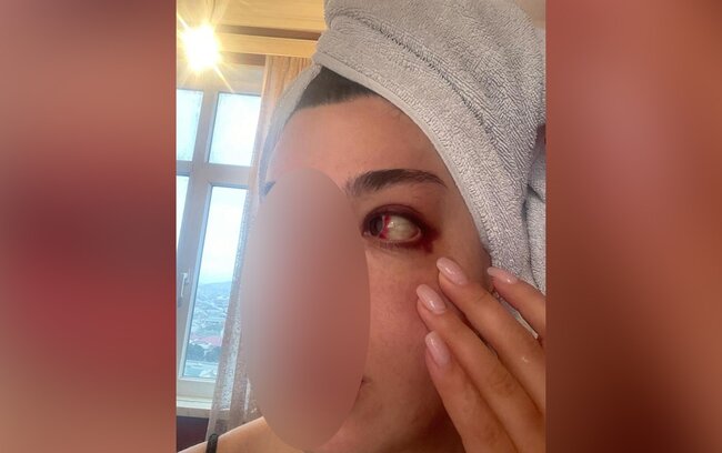 Eks-sevgilisindən Hidayətə ittihamlar - "550 min pulumu ələ keçirib, məni dəfələrlə döyüb"