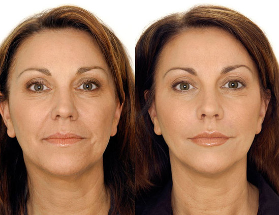 Goji cavanlaşdırıcı kremi ilə cavanlaşın!