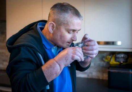 İki əlini də kəsib yenilərini tikdilər - FOTO-VİDEO +18