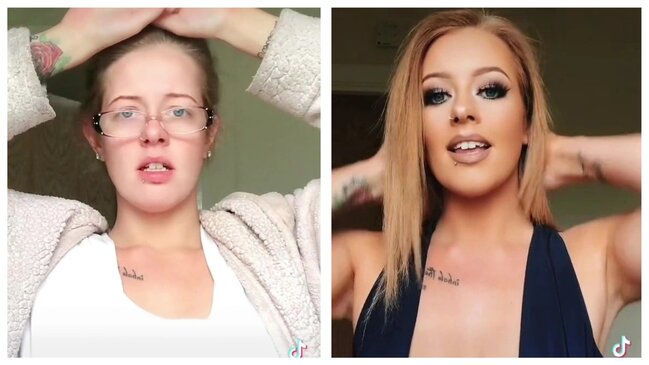 Dişsiz "çirkin ördəkdən" gözələ çevrilib söyüldü - FOTO-VİDEO