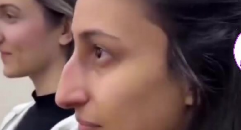 Bakıda 3 bacının əməliyyatı: Sonrakı görüntüləri təəccübləndirdi - VİDEO