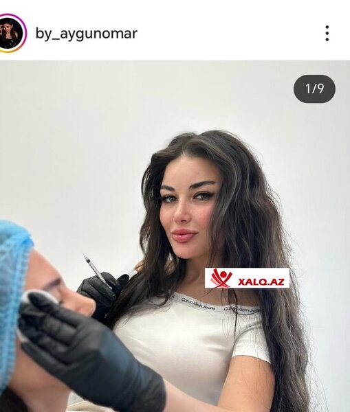 Kosmetoloq Aygün Ömərova lisenziyasız nece inyeksiya prosedurlarını həyata keçirir?