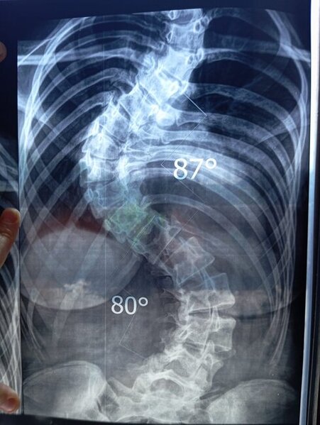 Səkinənin sizin köməyinizə ehtiyacı var