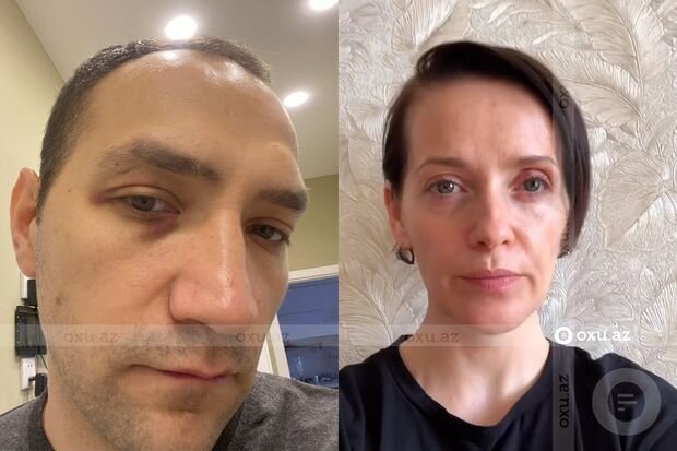 Anastasiyanın ərinin vəkilindən ittihamlara cavab: "Arvadı da bir neçə dəfə ona əl qaldırıb" - FOTO