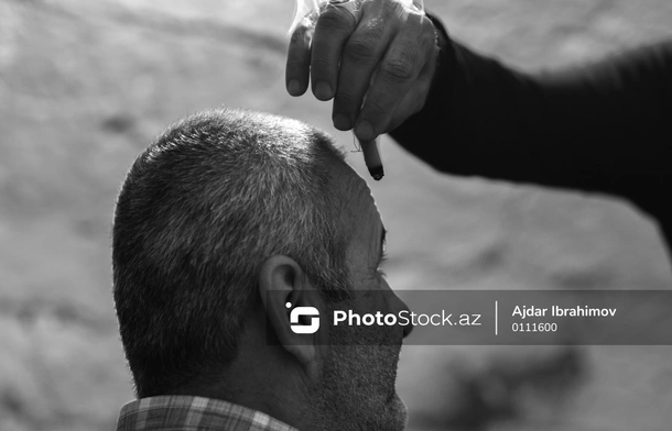 Qədim türkəçarə üsullarından biri olan ÇILDAQ