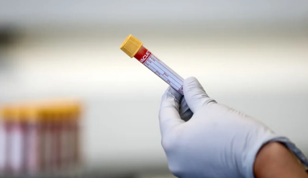 Nikahdan əvvəl narkotest tələbi və reallıqlar: Mütəxəssislər nə düşünürlər?