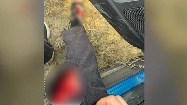 AzTV-nin müxbiri təyyarənin qəzaya düşdüyü ərazidə yaralandı