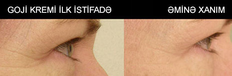 Goji cavanlaşdırıcı kremi ilə cavanlaşın!