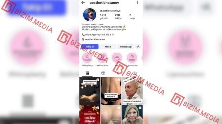 Nurlan Həsənli yenidən iş başında: Qanunsuz estetik əməliyyatlar