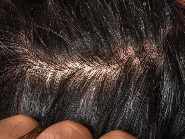 Çox addam ciddiyə almır - Ağır xəstəliklərin əlaməti ola bilər