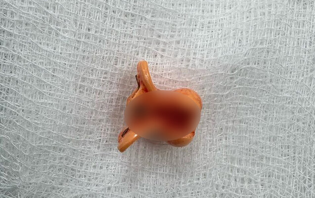 2 yaşlı uşaq saç sancağı uddu - Foto