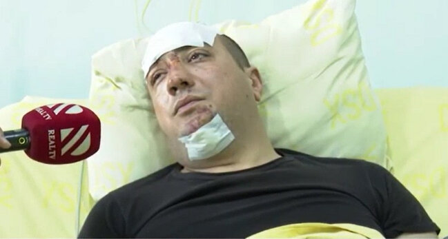 Helikopter qəzasından sağ çıxan digər hərbçi danışdı - VİDEO