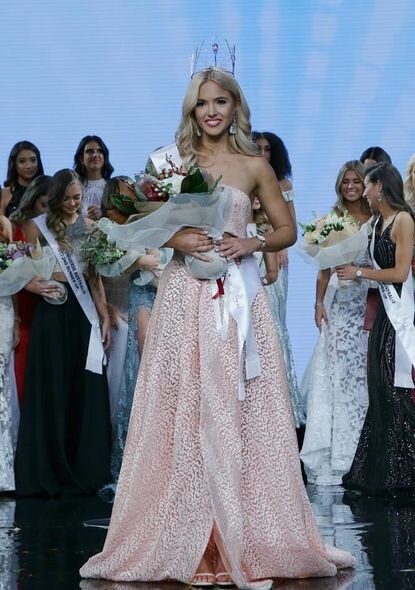 Model COVID-19-un qeyri-adi fəsadından danışdı - FOTO