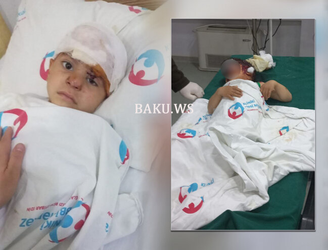 Sahibsiz itlər həyətdə oynayan uşaqlara hücum çəkdilər - İki uşaq ağır xəsarətlər alıb - FOTO