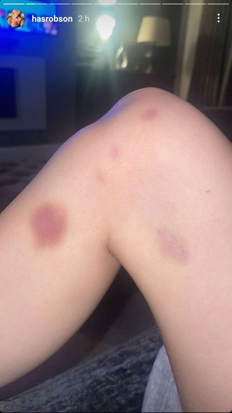 Sevgilisi məşhur futbolçunun onu döydüyünü iddia edir - FOTO/VİDEO