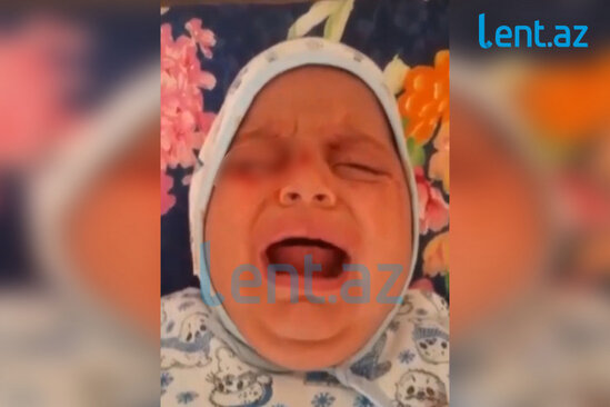Azərbaycanda ŞOK: Körpənin gözlərinə COVID diaqnozu qoyuldu, qan gəlir - VİDEO