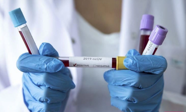 Payız gəldi, viruslar aktivləşdi: Mütəxəssislərdən vacib XƏBƏRDARLIQ