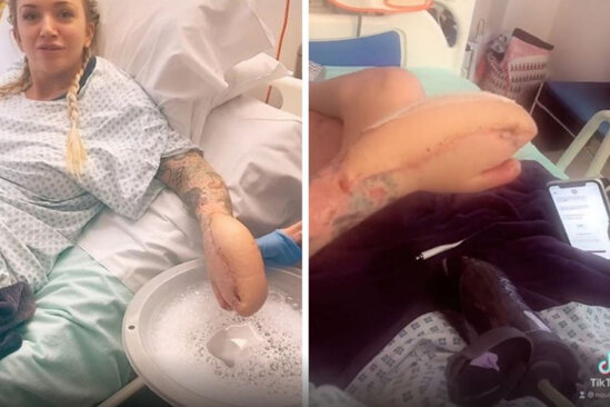 Bu qadının qolu balinanın başına bənzəyir