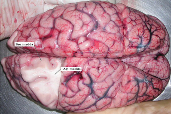 Başımızda gəzdirdiyimiz SUPERKOMPÜTER – Beyin haqqında 26 fakt