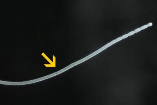 Dünyada ən böyük bakteriya aşkar edildi