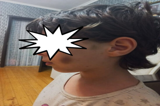 Narkoman ananın sevgilisi uşaqları DÖYDÜ -FOTO