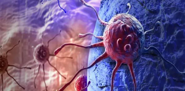 Xərçəngdən ölüm sayı 2050-ci ilə qədər ikiqat artacaq - Araşdırma