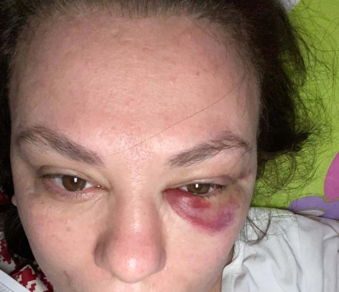 Avtobusda oturacaq üstündə DAVA: Kişi qadına yumruq atdı -FOTO