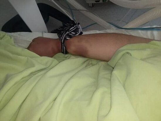 İntihar etdiyi deyilən 22 yaşlı Elnarənin ailəsi: "Onu öldürüblər" - FOTO