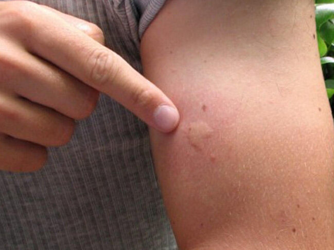 Yayda görünməz təhlükədən necə qorunaq?