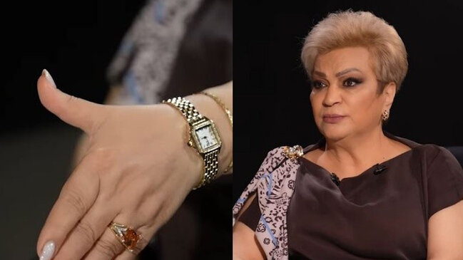 Xalq artisti: "Mənə zülm edirdi, bu bıçaq yarası da ondan qalıb" (VİDEO)