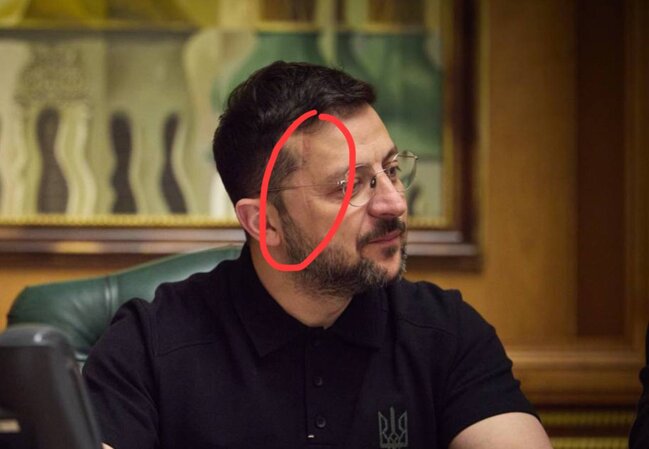 Zelenskinin üzünə nə olub? - Foto