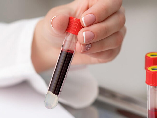 Bu qan qrupundan olan insanlara pis xəbər