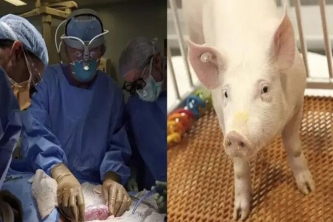 60 gündən çoxdur donuz böyrəyi ilə yaşayır