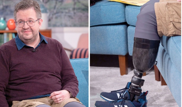 Britaniyalı cərrah sığortadan pul almaq üçün öz ayaqlarını amputasiya etdirib