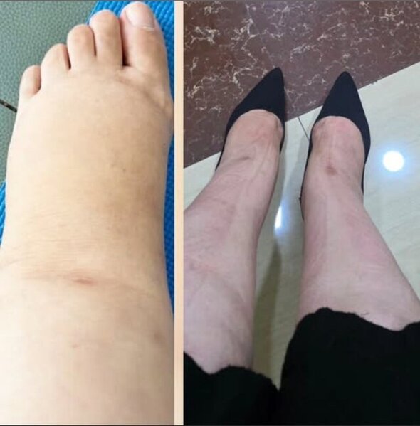 Aybəniz Haşımovanın səhhətində problem yarandı