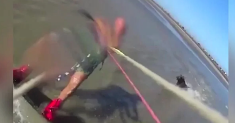 Dəhşət! Pitbull sörfçüyə hücum etdi - VİDEO