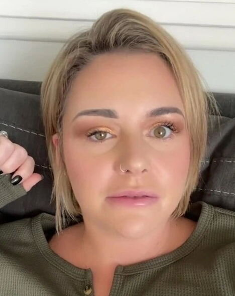 Botoks elətdirən qadının üzü iflic oldu - FOTO - VİDEO