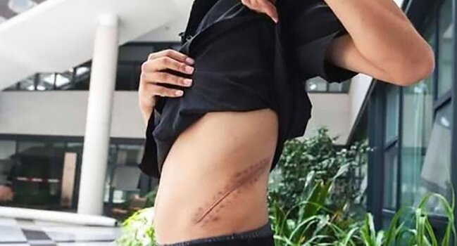 "iPhone" almaq üçün böyrəyini satıbmış - FOTO