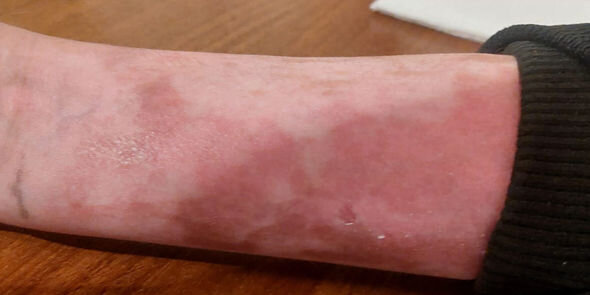 Bakıda ailəsi tərəfindən döyülən məktəbli qız sığınacağa yerləşdirildi - YENİLƏNİB + FOTO