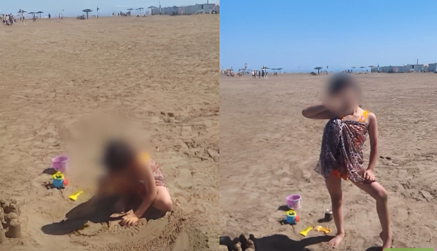 8 yaşlı qızın bədənində siqaret söndürüblər? - İddiada adı hallanan ana DANIŞDI