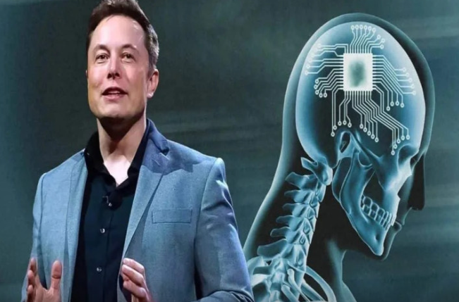 İlon Mask 2026-cı ilə qədər 1000 nəfərə çip taxacaq