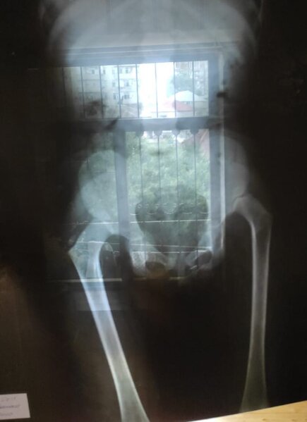 Aytənin köməyinizə ehtiyacı var